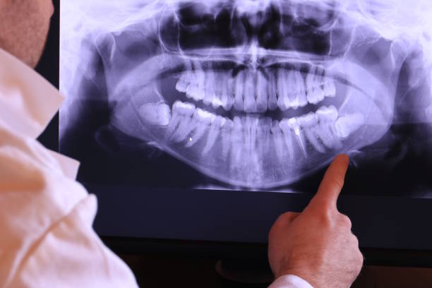 Best Emergency Wisdom Teeth Removal in Village Green, NY