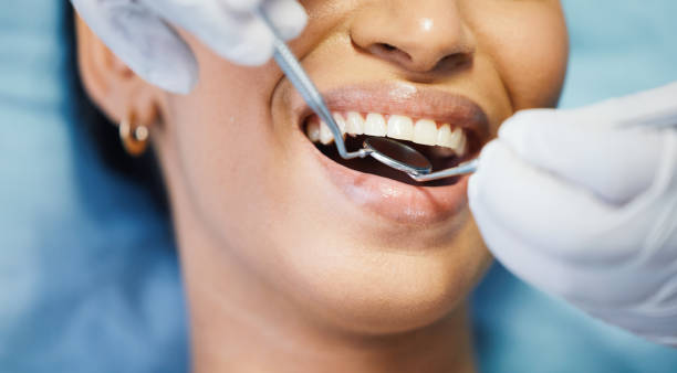 Best Emergency Dental Care for Broken or Chipped Teeth in Village Green, NY